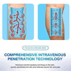 Advanced Vein Laser Pen - Treat Varicose Veins, Reduce Leg Swelling